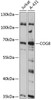 Western blot analysis of extracts of various cell lines, using COG8 antibody (15-501) at 1:3000 dilution.<br/>Secondary antibody: HRP Goat Anti-Rabbit IgG (H+L) at 1:10000 dilution.<br/>Lysates/proteins: 25ug per lane.<br/>Blocking buffer: 3% nonfat dry milk in TBST.<br/>Detection: ECL Basic Kit.<br/>Exposure time: 10s.