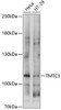 Western blot analysis of extracts of various cell lines, using TMTC3 antibody (15-623) at 1:1000 dilution.<br/>Secondary antibody: HRP Goat Anti-Rabbit IgG (H+L) at 1:10000 dilution.<br/>Lysates/proteins: 25ug per lane.<br/>Blocking buffer: 3% nonfat dry milk in TBST.<br/>Detection: ECL Basic Kit.<br/>Exposure time: 5s.