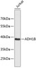 Western blot analysis of extracts of Jurkat cells, using ADH1B antibody (15-633) .<br/>Secondary antibody: HRP Goat Anti-Rabbit IgG (H+L) at 1:10000 dilution.<br/>Lysates/proteins: 25ug per lane.<br/>Blocking buffer: 3% nonfat dry milk in TBST.