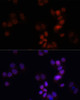 Immunofluorescence analysis of HCT116 cells using KDM7A antibody (15-667) at dilution of 1:150. Blue: DAPI for nuclear staining.