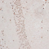 Immunohistochemistry of paraffin-embedded mouse brain using ZNF177 antibody (15-736) at dilution of 1:100 (40x lens) .