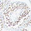 Immunohistochemistry of paraffin-embedded mouse testis using DDX21 antibody (15-748) at dilution of 1:100 (40x lens) .