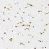 Immunohistochemistry of paraffin-embedded mouse brain using DDX21 antibody (15-748) at dilution of 1:100 (40x lens) .