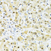 Immunohistochemistry of paraffin-embedded human liver using ITGB3BP antibody (15-764) at dilution of 1:100 (40x lens) .