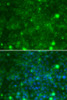 Immunofluorescence analysis of MCF-7 cells using TIMP3 antibody (15-883) . Blue: DAPI for nuclear staining.