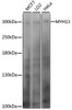 Western blot analysis of extracts of various cell lines, using MYH13 antibody (15-999) at 1:1000 dilution.<br/>Secondary antibody: HRP Goat Anti-Rabbit IgG (H+L) at 1:10000 dilution.<br/>Lysates/proteins: 25ug per lane.<br/>Blocking buffer: 3% nonfat dry milk in TBST.<br/>Detection: ECL Basic Kit.<br/>Exposure time: 20s.