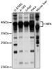 Western blot analysis of extracts of various cell lines, using NIFK antibody (16-125) at 1:1000 dilution.<br/>Secondary antibody: HRP Goat Anti-Rabbit IgG (H+L) at 1:10000 dilution.<br/>Lysates/proteins: 25ug per lane.<br/>Blocking buffer: 3% nonfat dry milk in TBST.<br/>Detection: ECL Basic Kit.<br/>Exposure time: 15s.