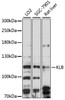 Western blot analysis of extracts of various cell lines, using KLB antibody (16-148) at 1:1000 dilution.<br/>Secondary antibody: HRP Goat Anti-Rabbit IgG (H+L) at 1:10000 dilution.<br/>Lysates/proteins: 25ug per lane.<br/>Blocking buffer: 3% nonfat dry milk in TBST.<br/>Detection: ECL Basic Kit.<br/>Exposure time: 90s.