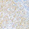 Immunohistochemistry of paraffin-embedded rat ovary using BMP2 antibody (16-158) at dilution of 1:100 (40x lens) .