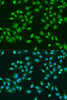 Immunofluorescence analysis of U2OS cells using RPS6KB1 antibody (16-196) at dilution of 1:100. Blue: DAPI for nuclear staining.