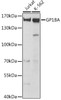 Western blot analysis of extracts of various cell lines, using GP1BA antibody (16-397) at 1:1000 dilution.<br/>Secondary antibody: HRP Goat Anti-Rabbit IgG (H+L) at 1:10000 dilution.<br/>Lysates/proteins: 25ug per lane.<br/>Blocking buffer: 3% nonfat dry milk in TBST.<br/>Detection: ECL Basic Kit.<br/>Exposure time: 1s.