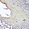 Immunohistochemistry of paraffin-embedded human tonsil using KRT1 antibody (16-521) at dilution of 1:100 (40x lens) .