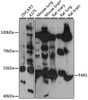 Western blot analysis of extracts of various cell lines, using FAR1 antibody (16-526) at 1:3000 dilution.<br/>Secondary antibody: HRP Goat Anti-Rabbit IgG (H+L) at 1:10000 dilution.<br/>Lysates/proteins: 25ug per lane.<br/>Blocking buffer: 3% nonfat dry milk in TBST.<br/>Detection: ECL Basic Kit.<br/>Exposure time: 60s.