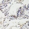 Immunohistochemistry of paraffin-embedded human lung using NAV2 antibody (16-535) at dilution of 1:100 (40x lens) .