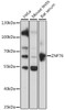 Western blot analysis of extracts of various cell lines, using ZNF76 antibody (16-686) at 1:1000 dilution.<br/>Secondary antibody: HRP Goat Anti-Rabbit IgG (H+L) at 1:10000 dilution.<br/>Lysates/proteins: 25ug per lane.<br/>Blocking buffer: 3% nonfat dry milk in TBST.<br/>Detection: ECL Basic Kit.<br/>Exposure time: 30s.