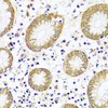 Immunohistochemistry of paraffin-embedded human stomach using CAPN9 antibody (16-860) at dilution of 1:100 (40x lens) .