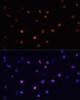 Immunofluorescence analysis of C6 cells using Ki67 antibody (16-921) at dilution of 1:100. Blue: DAPI for nuclear staining.