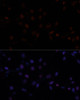 Immunofluorescence analysis of NIH-3T3 cells using Ki67 antibody (16-921) at dilution of 1:100. Blue: DAPI for nuclear staining.