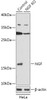 Western blot analysis of extracts from normal (control) and NGF knockout (KO) HeLa cells, using NGF antibody (18-184) at 1:1000 dilution.<br/>Secondary antibody: HRP Goat Anti-Rabbit IgG (H+L) at 1:10000 dilution.<br/>Lysates/proteins: 25ug per lane.<br/>Blocking buffer: 3% nonfat dry milk in TBST.<br/>Detection: ECL Basic Kit.<br/>Exposure time: 90s.