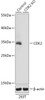 Western blot analysis of extracts from normal (control) and CDK2 knockout (KO) 293T cells, using CDK2 antibody (18-187) at 1:3000 dilution.<br/>Secondary antibody: HRP Goat Anti-Rabbit IgG (H+L) at 1:10000 dilution.<br/>Lysates/proteins: 25ug per lane.<br/>Blocking buffer: 3% nonfat dry milk in TBST.<br/>Detection: ECL Basic Kit.<br/>Exposure time: 5s.