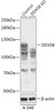 Western blot analysis of extracts from normal (control) and DDX58 knockout (KO) A-549 cells, using DDX58 antibody (18-190) at 1:500 dilution.<br/>Secondary antibody: HRP Goat Anti-Rabbit IgG (H+L) at 1:10000 dilution.<br/>Lysates/proteins: 25ug per lane.<br/>Blocking buffer: 3% nonfat dry milk in TBST.<br/>Detection: ECL Basic Kit.<br/>Exposure time: 1min.