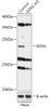 Western blot analysis of extracts from normal (control) and EDN1 knockout (KO) HeLa cells, using EDN1 antibody (18-191) at 1:1000 dilution.<br/>Secondary antibody: HRP Goat Anti-Rabbit IgG (H+L) at 1:10000 dilution.<br/>Lysates/proteins: 25ug per lane.<br/>Blocking buffer: 3% nonfat dry milk in TBST.<br/>Detection: ECL Basic Kit.<br/>Exposure time: 1min.