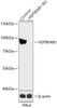 Western blot analysis of extracts from normal (control) and HSP90AB1 knockout (KO) HeLa cells, using HSP90AB1 antibody (18-202) at 1:1000 dilution.<br/>Secondary antibody: HRP Goat Anti-Rabbit IgG (H+L) at 1:10000 dilution.<br/>Lysates/proteins: 25ug per lane.<br/>Blocking buffer: 3% nonfat dry milk in TBST.<br/>Detection: ECL Basic Kit.<br/>Exposure time: 90s.