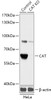 Western blot analysis of extracts from normal (control) and CAT knockout (KO) HeLa cells, using CAT antibody (18-205) at 1:3000 dilution.<br/>Secondary antibody: HRP Goat Anti-Rabbit IgG (H+L) at 1:10000 dilution.<br/>Lysates/proteins: 25ug per lane.<br/>Blocking buffer: 3% nonfat dry milk in TBST.<br/>Detection: ECL Basic Kit.<br/>Exposure time: 10s.