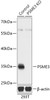 Western blot analysis of extracts from normal (control) and PSME3 knockout (KO) 293T cells, using PSME3 antibody (18-209) at 1:3000 dilution.<br/>Secondary antibody: HRP Goat Anti-Rabbit IgG (H+L) at 1:10000 dilution.<br/>Lysates/proteins: 25ug per lane.<br/>Blocking buffer: 3% nonfat dry milk in TBST.<br/>Detection: ECL Basic Kit.<br/>Exposure time: 3min.