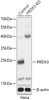 Western blot analysis of extracts from normal (control) and PRDX3 knockout (KO) HeLa cells, using PRDX3 antibody (18-210) at 1:3000 dilution.<br/>Secondary antibody: HRP Goat Anti-Rabbit IgG (H+L) at 1:10000 dilution.<br/>Lysates/proteins: 25ug per lane.<br/>Blocking buffer: 3% nonfat dry milk in TBST.<br/>Detection: ECL Basic Kit.<br/>Exposure time: 1min.