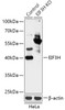 Western blot analysis of extracts from normal (control) and EIF3H knockout (KO) HeLa cells, using EIF3H antibody (18-214) at 1:3000 dilution.<br/>Secondary antibody: HRP Goat Anti-Rabbit IgG (H+L) at 1:10000 dilution.<br/>Lysates/proteins: 25ug per lane.<br/>Blocking buffer: 3% nonfat dry milk in TBST.<br/>Detection: ECL Basic Kit.<br/>Exposure time: 10s.