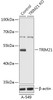 Western blot analysis of extracts from normal (control) and TRIM21 knockout (KO) A-549 cells, using TRIM21 antibody (18-215) at 1:1000 dilution.<br/>Secondary antibody: HRP Goat Anti-Rabbit IgG (H+L) at 1:10000 dilution.<br/>Lysates/proteins: 25ug per lane.<br/>Blocking buffer: 3% nonfat dry milk in TBST.<br/>Detection: ECL Basic Kit.<br/>Exposure time: 1s.