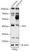 Western blot analysis of extracts from normal (control) and ADA knockout (KO) HeLa cells, using ADA antibody (18-217) at 1:3000 dilution.<br/>Secondary antibody: HRP Goat Anti-Rabbit IgG (H+L) at 1:10000 dilution.<br/>Lysates/proteins: 25ug per lane.<br/>Blocking buffer: 3% nonfat dry milk in TBST.<br/>Detection: ECL Basic Kit.<br/>Exposure time: 5s.