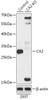 Western blot analysis of extracts from normal (control) and CA2 knockout (KO) 293T cells, using CA2 antibody (18-222) at 1:1000 dilution.<br/>Secondary antibody: HRP Goat Anti-Rabbit IgG (H+L) at 1:10000 dilution.<br/>Lysates/proteins: 25ug per lane.<br/>Blocking buffer: 3% nonfat dry milk in TBST.<br/>Detection: ECL Basic Kit.<br/>Exposure time: 5s.