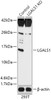 Western blot analysis of extracts from normal (control) and LGALS1 knockout (KO) 293T cells, using LGALS1 antibody (18-228) at 1:1000 dilution.<br/>Secondary antibody: HRP Goat Anti-Rabbit IgG (H+L) at 1:10000 dilution.<br/>Lysates/proteins: 25ug per lane.<br/>Blocking buffer: 3% nonfat dry milk in TBST.<br/>Detection: ECL Basic Kit.<br/>Exposure time: 3min.