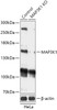 Western blot analysis of extracts from normal (control) and MAP3K1 knockout (KO) HeLa cells, using MAP3K1 antibody (18-229) at 1:1000 dilution.<br/>Secondary antibody: HRP Goat Anti-Rabbit IgG (H+L) at 1:10000 dilution.<br/>Lysates/proteins: 25ug per lane.<br/>Blocking buffer: 3% nonfat dry milk in TBST.<br/>Detection: ECL Basic Kit.<br/>Exposure time: 1min.