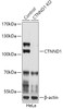 Western blot analysis of extracts from normal (control) and CTNND1 knockout (KO) HeLa cells, using CTNND1 antibody (18-231) at 1:1000 dilution.<br/>Secondary antibody: HRP Goat Anti-Rabbit IgG (H+L) at 1:10000 dilution.<br/>Lysates/proteins: 25ug per lane.<br/>Blocking buffer: 3% nonfat dry milk in TBST.<br/>Detection: ECL Basic Kit.<br/>Exposure time: 5s.