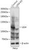 Western blot analysis of extracts from normal (control) and LIG4 knockout (KO) HeLa cells, using LIG4 antibody (18-239) at 1:1000 dilution.<br/>Secondary antibody: HRP Goat Anti-Rabbit IgG (H+L) at 1:10000 dilution.<br/>Lysates/proteins: 25ug per lane.<br/>Blocking buffer: 3% nonfat dry milk in TBST.<br/>Detection: ECL Basic Kit.<br/>Exposure time: 1min.