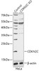 Western blot analysis of extracts from normal (control) and CDKN2C knockout (KO) HeLa cells, using CDKN2C antibody (18-243) at 1:1000 dilution.<br/>Secondary antibody: HRP Goat Anti-Rabbit IgG (H+L) at 1:10000 dilution.<br/>Lysates/proteins: 25ug per lane.<br/>Blocking buffer: 3% nonfat dry milk in TBST.<br/>Detection: ECL Basic Kit.<br/>Exposure time: 180s.