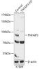 Western blot analysis of extracts from normal (control) and TNFAIP3 knockout (KO) A-549 cells, using TNFAIP3 antibody (18-245) at 1:1000 dilution.<br/>Secondary antibody: HRP Goat Anti-Rabbit IgG (H+L) at 1:10000 dilution.<br/>Lysates/proteins: 25ug per lane.<br/>Blocking buffer: 3% nonfat dry milk in TBST.<br/>Detection: ECL Basic Kit.<br/>Exposure time: 90s.