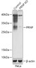 Western blot analysis of extracts from normal (control) and PRNP knockout (KO) HeLa cells, using PRNP antibody (18-247) at 1:1000 dilution.<br/>Secondary antibody: HRP Goat Anti-Rabbit IgG (H+L) at 1:10000 dilution.<br/>Lysates/proteins: 25ug per lane.<br/>Blocking buffer: 3% nonfat dry milk in TBST.<br/>Detection: ECL Basic Kit.<br/>Exposure time: 180s.