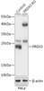 Western blot analysis of extracts from normal (control) and PRDX3 knockout (KO) HeLa cells, using PRDX3 antibody (18-251) at 1:500 dilution.<br/>Secondary antibody: HRP Goat Anti-Rabbit IgG (H+L) at 1:10000 dilution.<br/>Lysates/proteins: 25ug per lane.<br/>Blocking buffer: 3% nonfat dry milk in TBST.<br/>Detection: ECL Basic Kit.<br/>Exposure time: 1min.