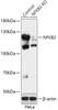 Western blot analysis of extracts from normal (control) and NFKB2 knockout (KO) HeLa cells, using NFKB2 antibody (18-252) at 1:1000 dilution.<br/>Secondary antibody: HRP Goat Anti-Rabbit IgG (H+L) at 1:10000 dilution.<br/>Lysates/proteins: 25ug per lane.<br/>Blocking buffer: 3% nonfat dry milk in TBST.<br/>Detection: ECL Basic Kit.<br/>Exposure time: 10s.