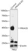 Western blot analysis of extracts from normal (control) and PRKACB knockout (KO) HeLa cells, using PRKACB antibody (18-257) at 1:1000 dilution.<br/>Secondary antibody: HRP Goat Anti-Rabbit IgG (H+L) at 1:10000 dilution.<br/>Lysates/proteins: 25ug per lane.<br/>Blocking buffer: 3% nonfat dry milk in TBST.<br/>Detection: ECL Basic Kit.<br/>Exposure time: 90s.