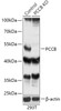 Western blot analysis of extracts from normal (control) and PCCB knockout (KO) 293T cells, using PCCB antibody (18-262) at 1:1000 dilution.<br/>Secondary antibody: HRP Goat Anti-Rabbit IgG (H+L) at 1:10000 dilution.<br/>Lysates/proteins: 25ug per lane.<br/>Blocking buffer: 3% nonfat dry milk in TBST.<br/>Detection: ECL Basic Kit.<br/>Exposure time: 10s.