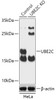 Western blot analysis of extracts from normal (control) and UBE2C knockout (KO) HeLa cells, using UBE2C antibody (18-265) at 1:1000 dilution.<br/>Secondary antibody: HRP Goat Anti-Rabbit IgG (H+L) at 1:10000 dilution.<br/>Lysates/proteins: 25ug per lane.<br/>Blocking buffer: 3% nonfat dry milk in TBST.<br/>Detection: ECL Basic Kit.<br/>Exposure time: 90s.