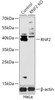 Western blot analysis of extracts from normal (control) and RNF2 knockout (KO) HeLa cells, using RNF2 antibody (18-266) at 1:1000 dilution.<br/>Secondary antibody: HRP Goat Anti-Rabbit IgG (H+L) at 1:10000 dilution.<br/>Lysates/proteins: 25ug per lane.<br/>Blocking buffer: 3% nonfat dry milk in TBST.<br/>Detection: ECL Basic Kit.<br/>Exposure time: 180s.