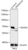 Western blot analysis of extracts from normal (control) and SMAD4 knockout (KO) HeLa cells, using SMAD4 antibody (18-268) at 1:1000 dilution.<br/>Secondary antibody: HRP Goat Anti-Rabbit IgG (H+L) at 1:10000 dilution.<br/>Lysates/proteins: 25ug per lane.<br/>Blocking buffer: 3% nonfat dry milk in TBST.<br/>Detection: ECL Basic Kit.<br/>Exposure time: 1s.