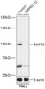 Western blot analysis of extracts from normal (control) and BMPR2 knockout (KO) HeLa cells, using BMPR2 antibody (18-269) at 1:1000 dilution.<br/>Secondary antibody: HRP Goat Anti-Rabbit IgG (H+L) at 1:10000 dilution.<br/>Lysates/proteins: 25ug per lane.<br/>Blocking buffer: 3% nonfat dry milk in TBST.<br/>Detection: ECL Basic Kit.<br/>Exposure time: 10s.