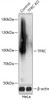 Western blot analysis of extracts from normal (control) and TFRC knockout (KO) HeLa cells, using TFRC antibody (18-274) at 1:5000 dilution.<br/>Secondary antibody: HRP Goat Anti-Rabbit IgG (H+L) at 1:10000 dilution.<br/>Lysates/proteins: 25ug per lane.<br/>Blocking buffer: 3% nonfat dry milk in TBST.<br/>Detection: ECL Basic Kit.<br/>Exposure time: 1s.